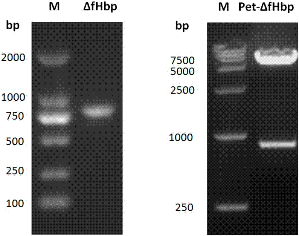 Multivalent pneumococcal conjugate vaccine and preparation method thereof