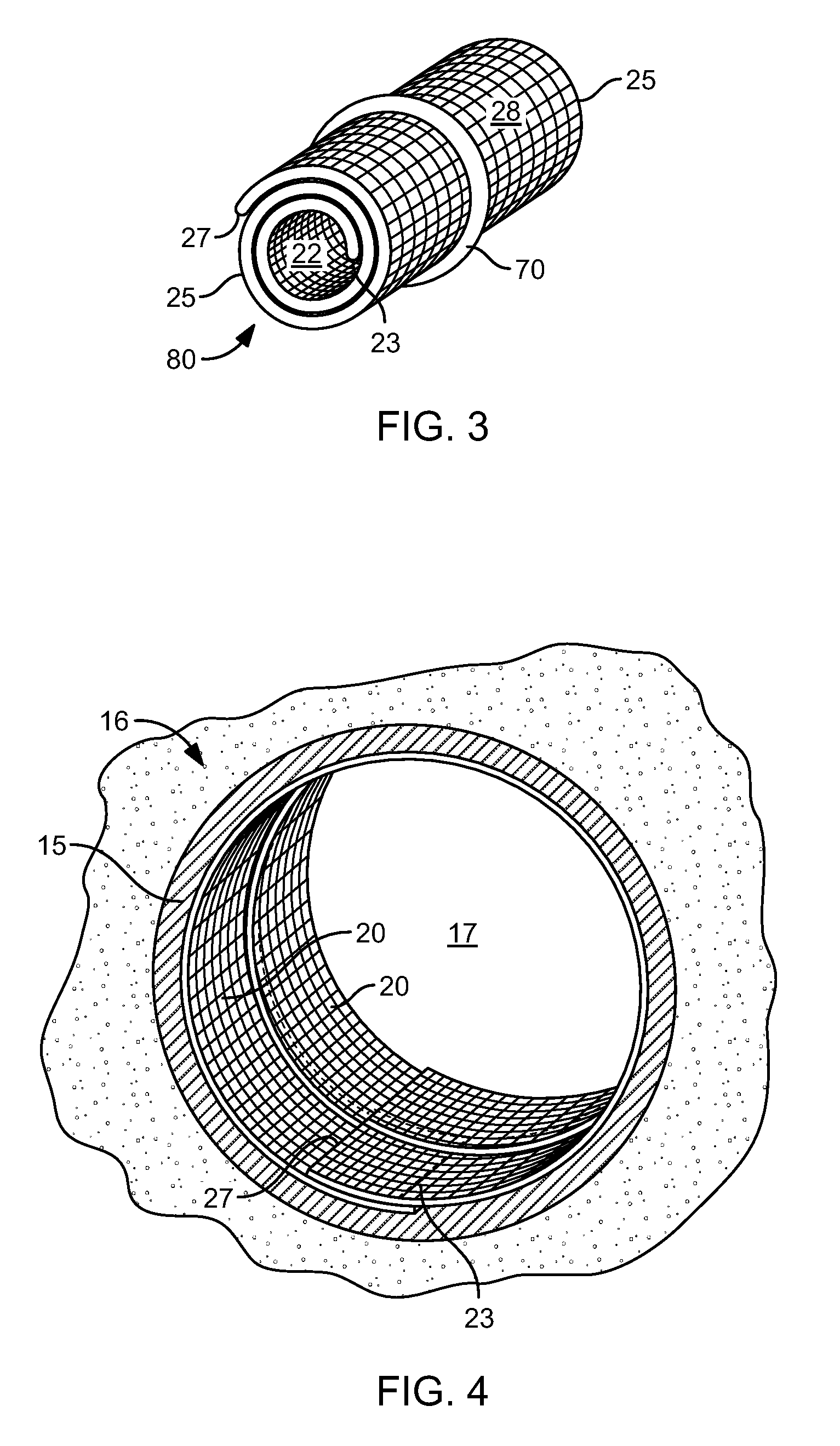 Apparatus and Method of Reinforcing a Conduit or Vessel