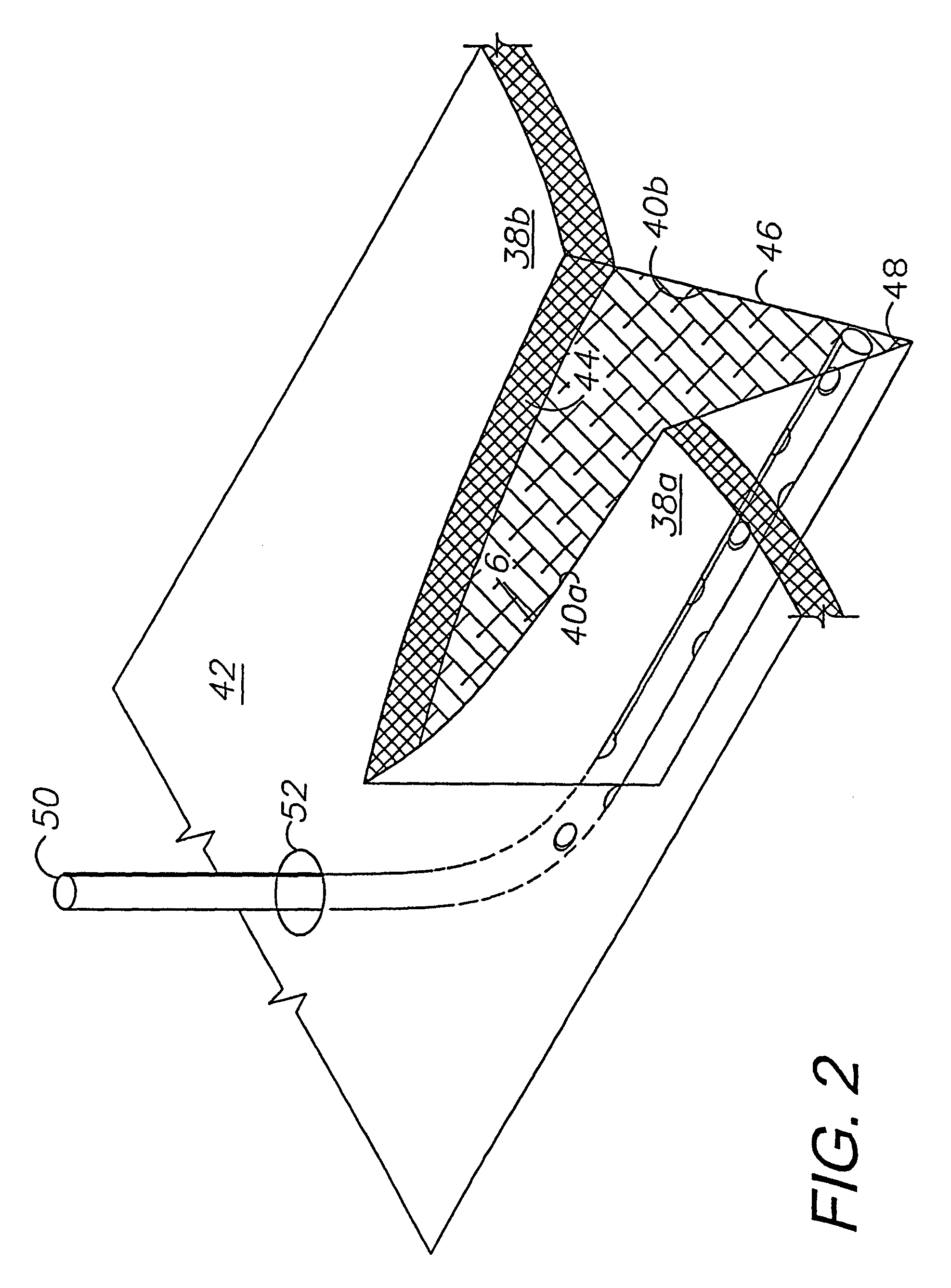 Externally-applied patient interface system and method