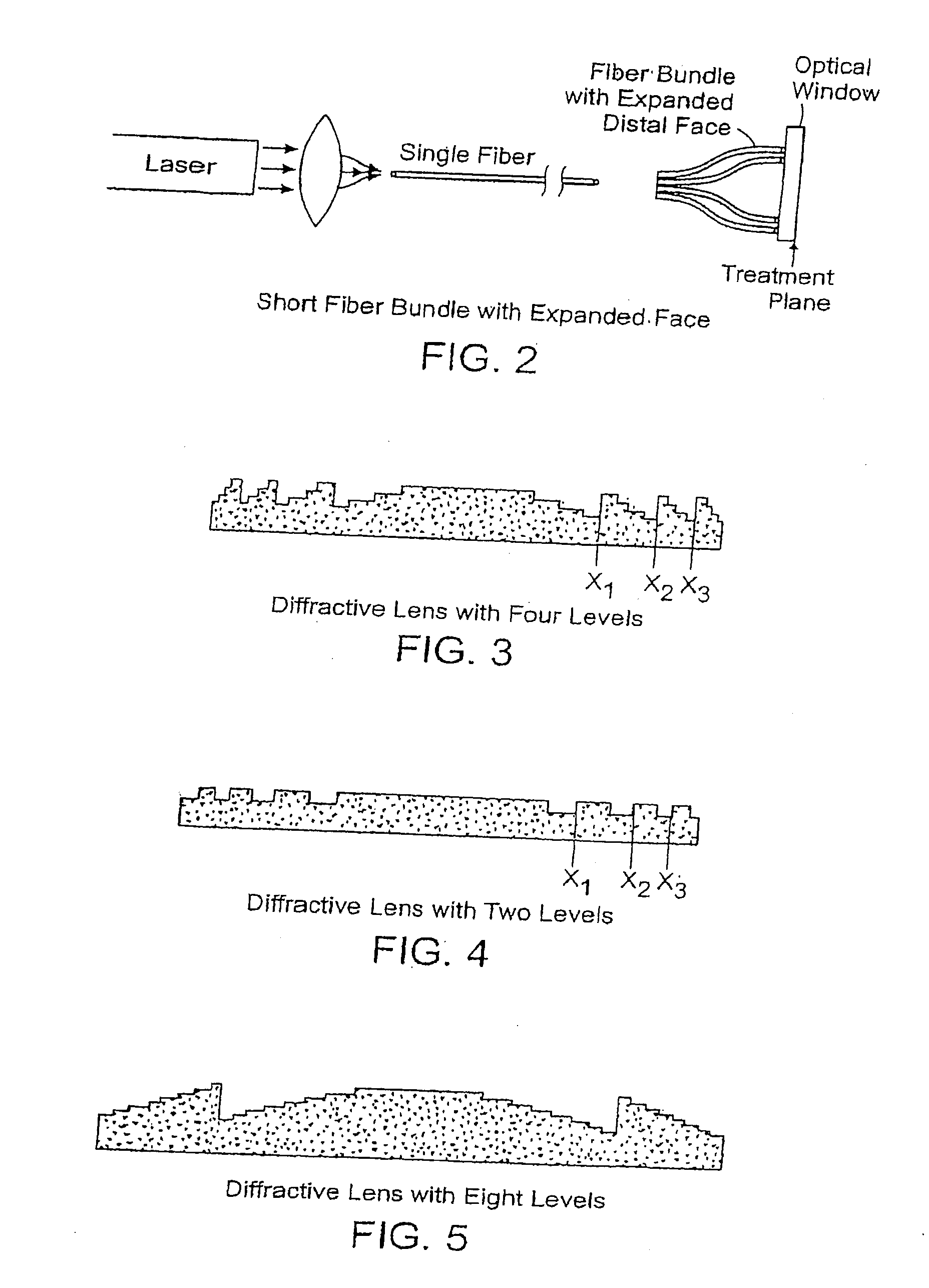 Methods And Systems For Laser Treatment Using Non-Uniform Output Beam