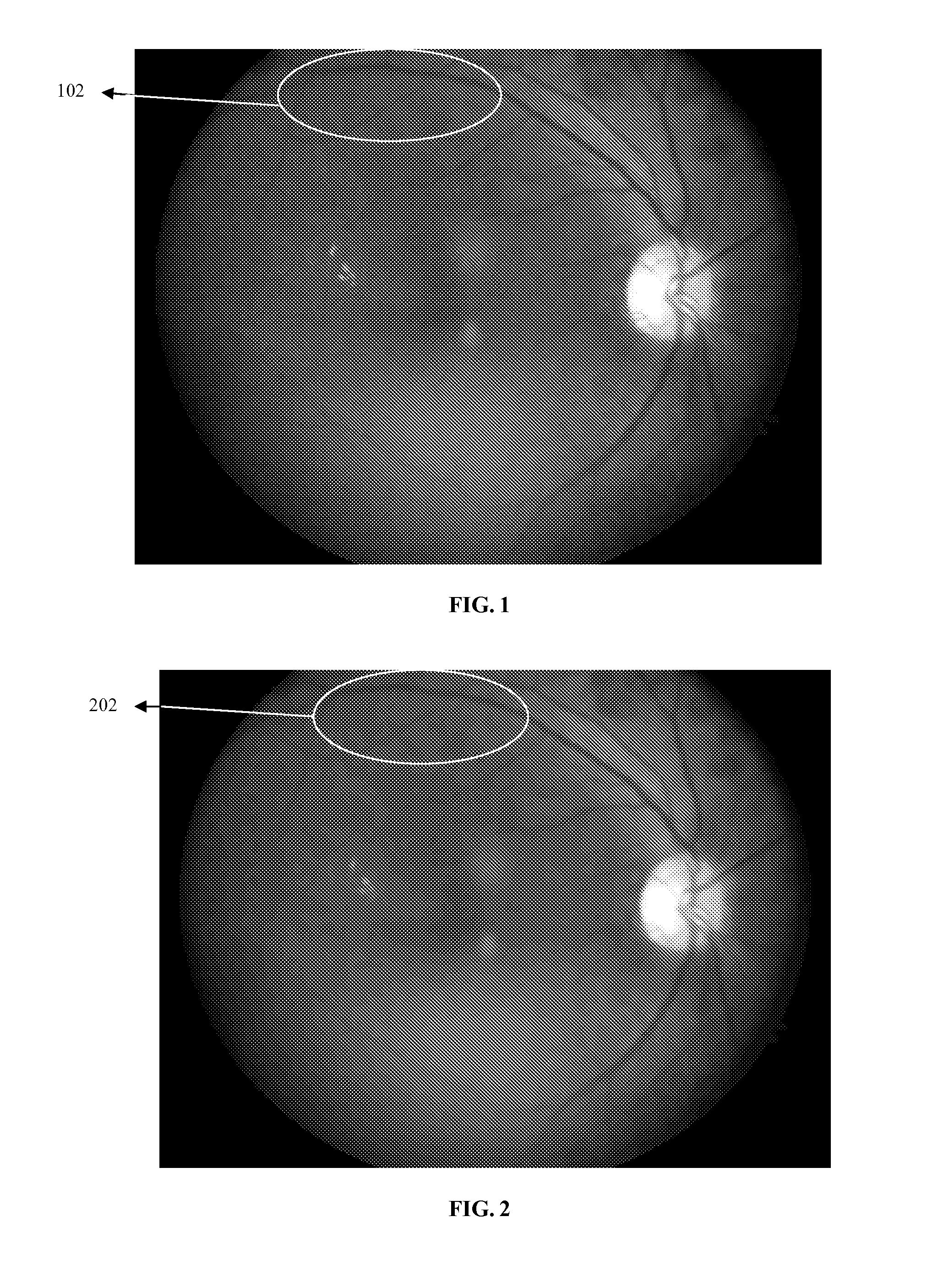 Method and system for enhancing image quality