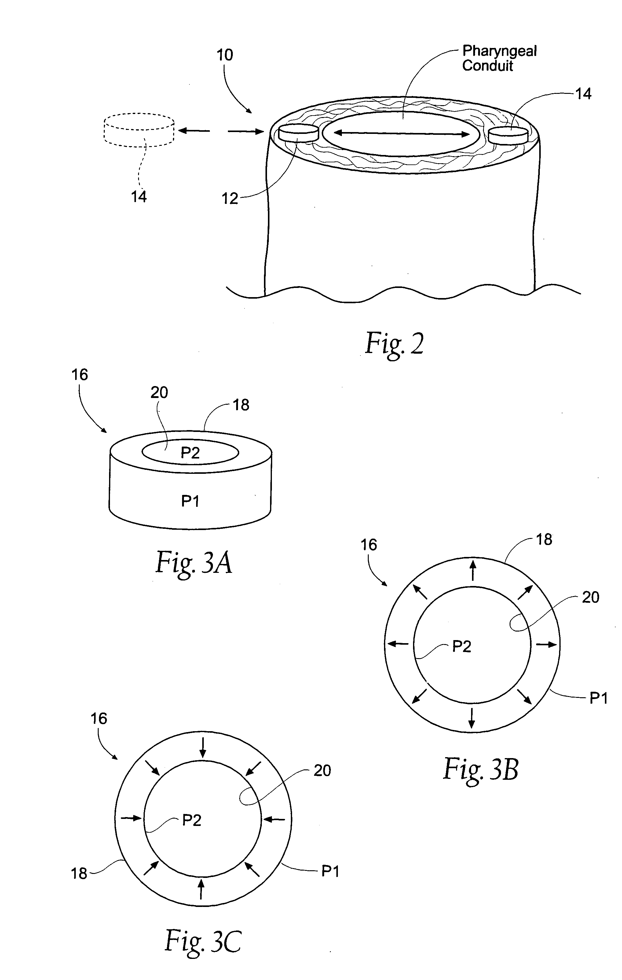 Magnetic force devices, systems, and methods for resisting tissue collapse within the pharyngeal conduit