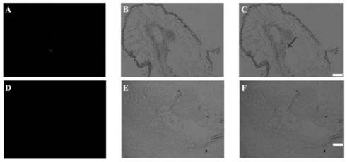 Gramineae root-knot nematode transcription factor MgBTF3 and application thereof in prevention and treatment of diseases