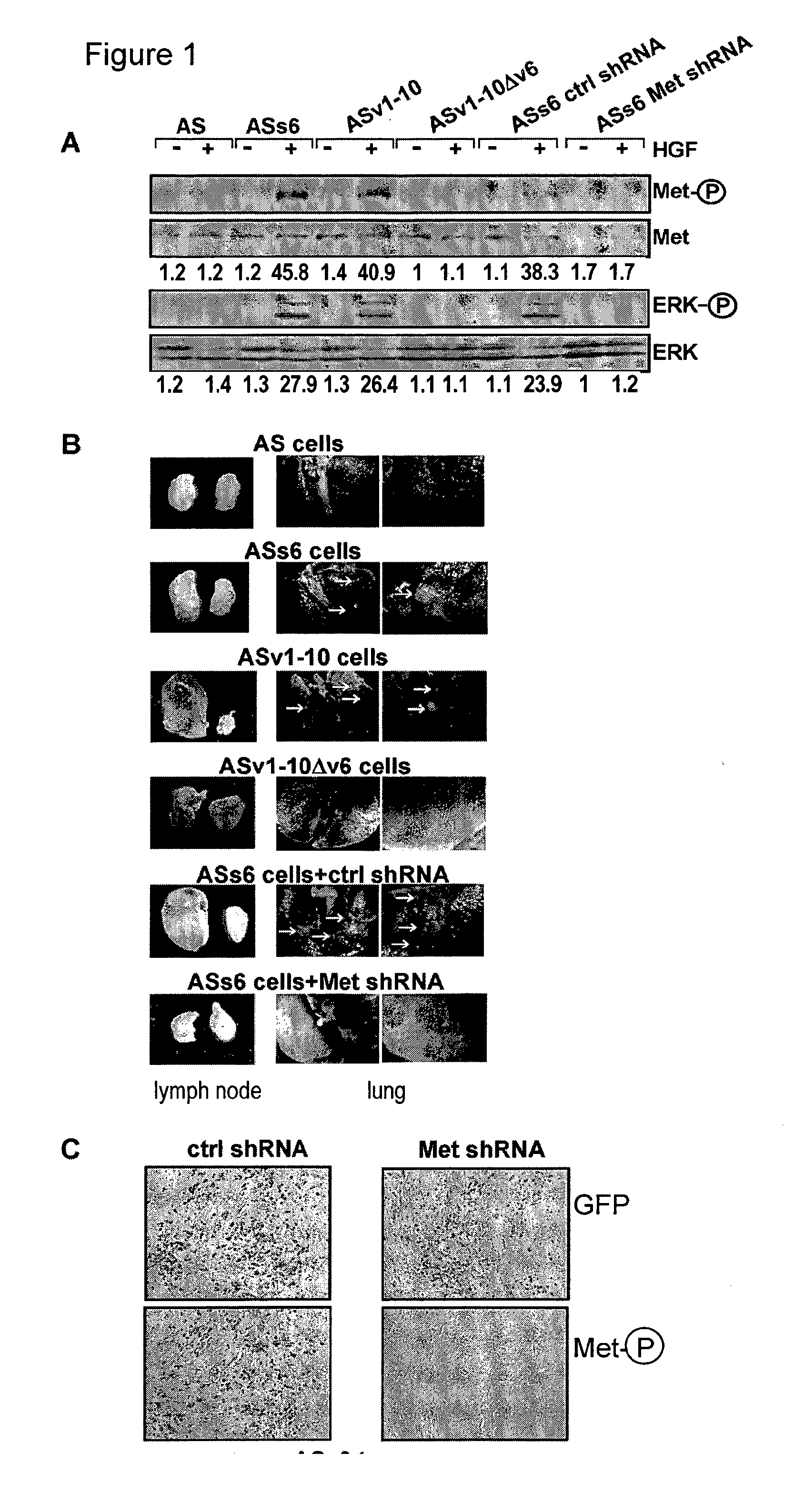 CD44V6-Derived Peptides for Treating Pancreatic Cancer