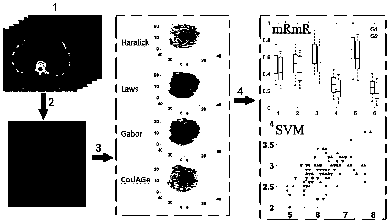 CT radiomics-based pancreatic neuroendocrine tumor grading method