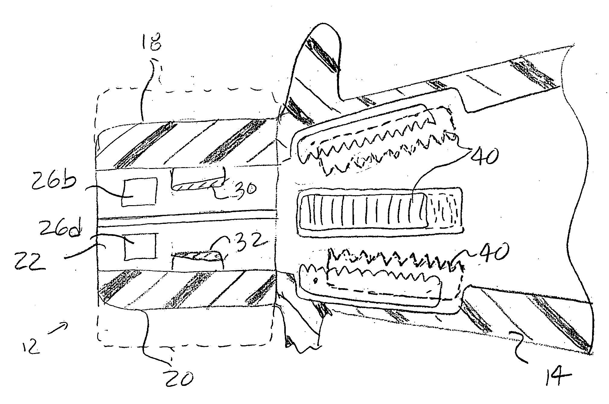 Assisted systems and methods for performing transvaginal hysterectomies