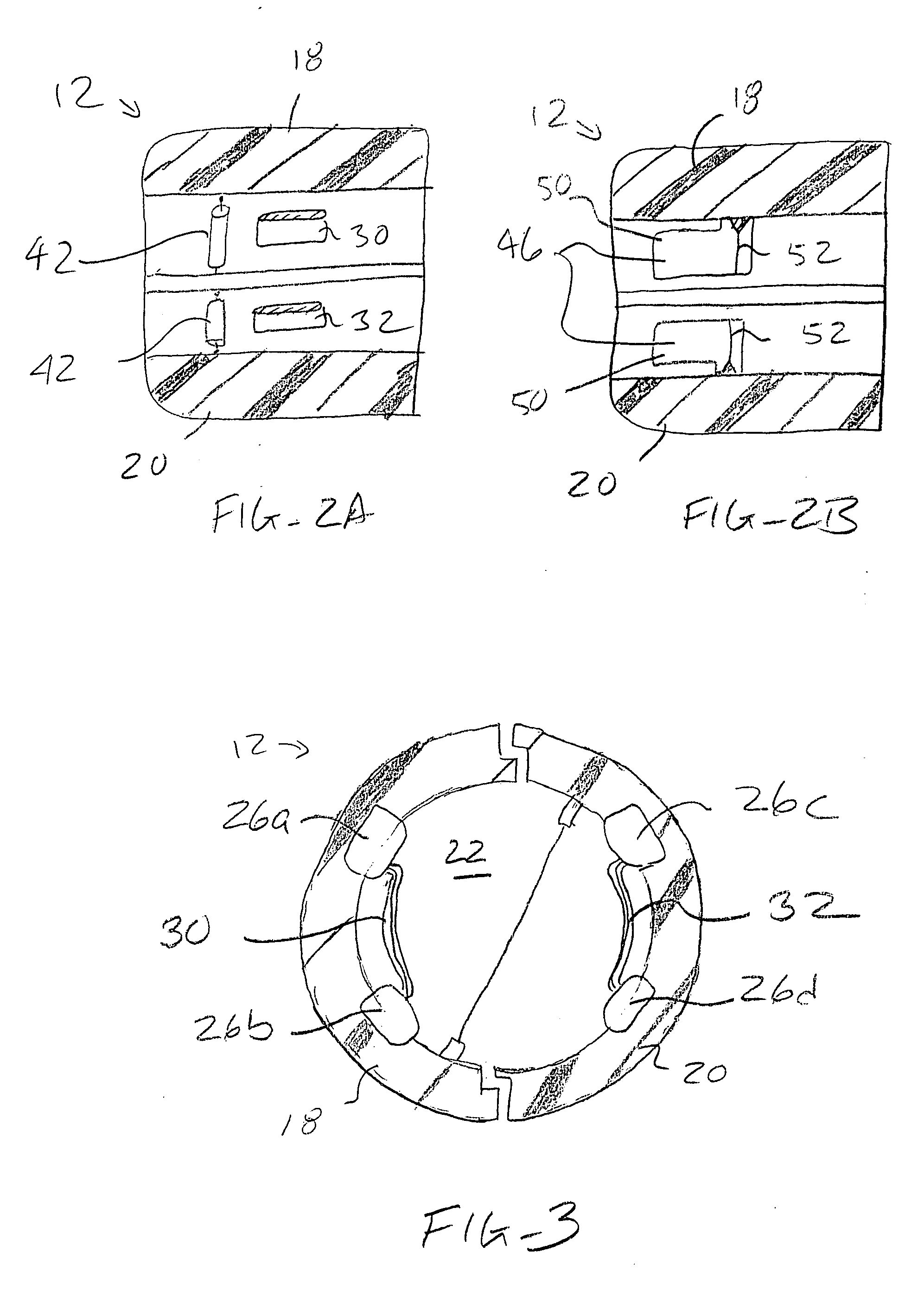 Assisted systems and methods for performing transvaginal hysterectomies