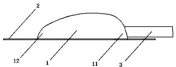 Delayed sternal closure skin incision seal and drainage device and application thereof