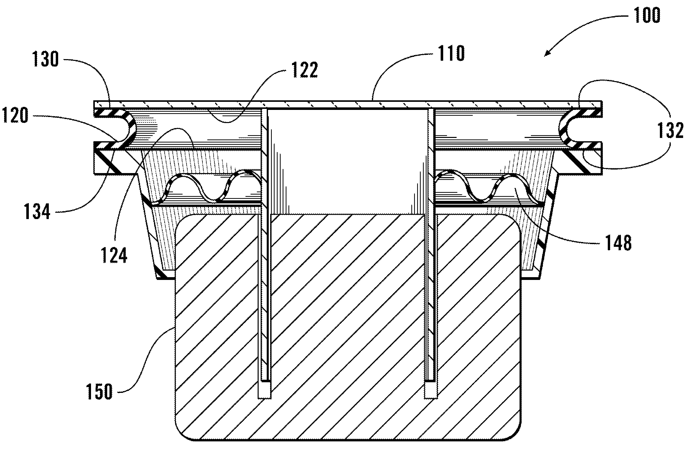 Loudspeaker with rear surround support