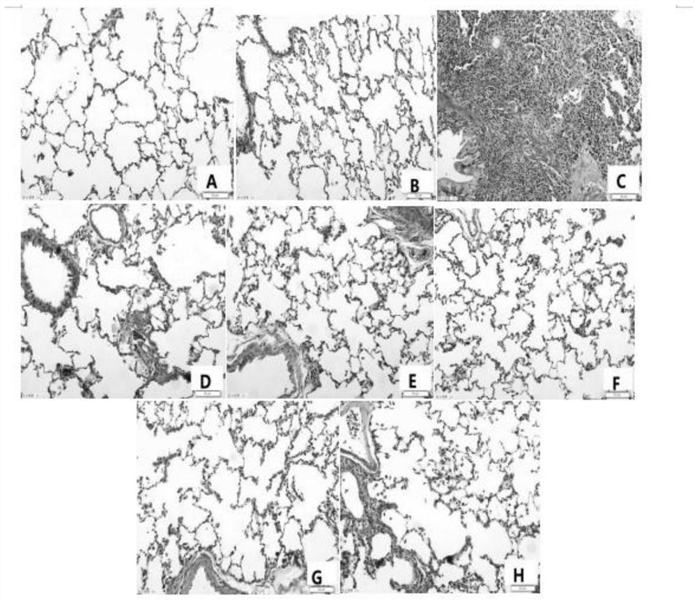 Pharmacological action research method of rana japonica oil freeze-dried powder for improving pulmonary fibrosis