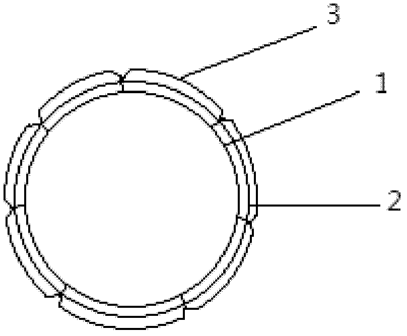 Blood vessel stent and preparation method thereof