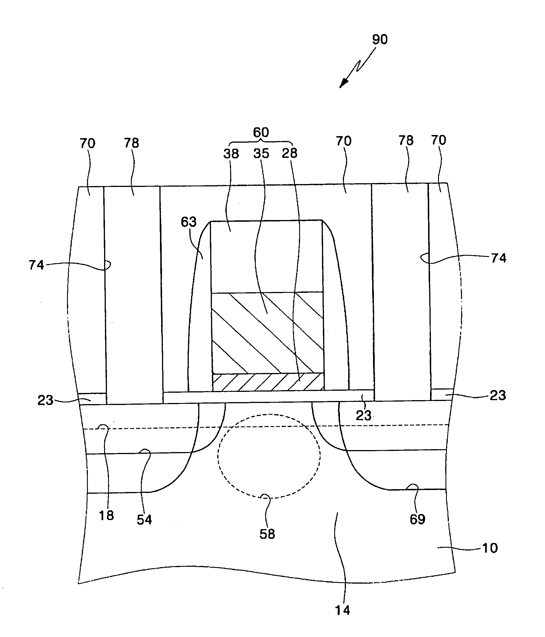 Transistor having a metal nitride layer pattern, etchant and methods of forming the same