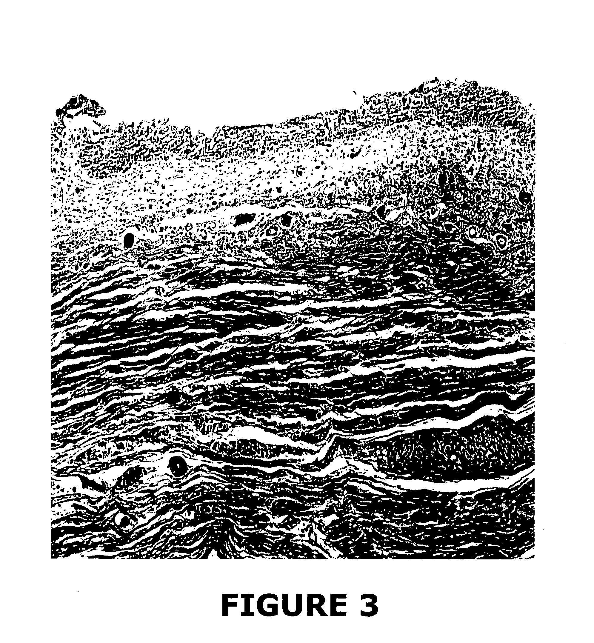 Urinary tract tissue graft compositions and methods for producing same