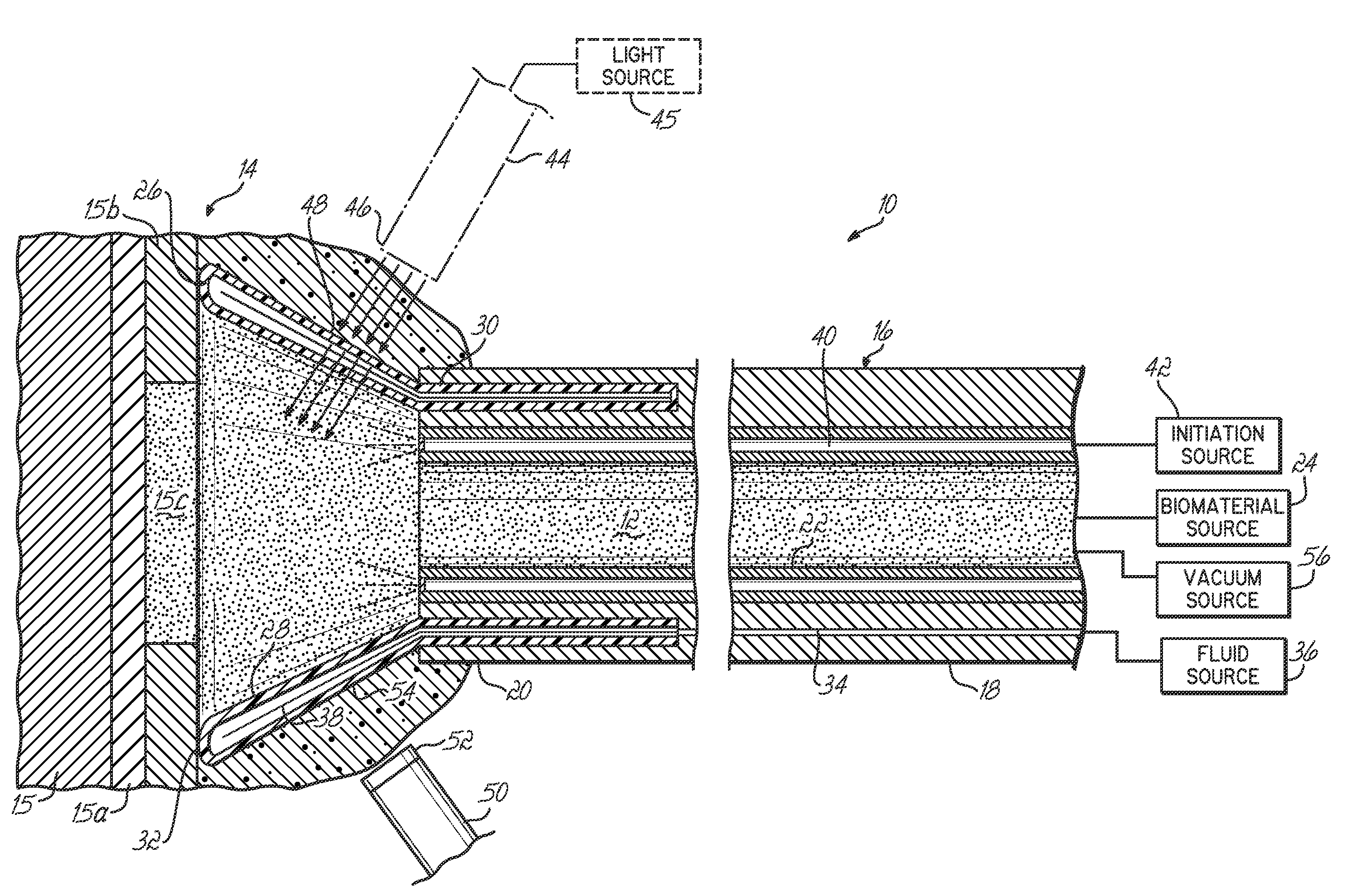 Apparatus for delivering a biocompatible material to a surgical site and method of using same