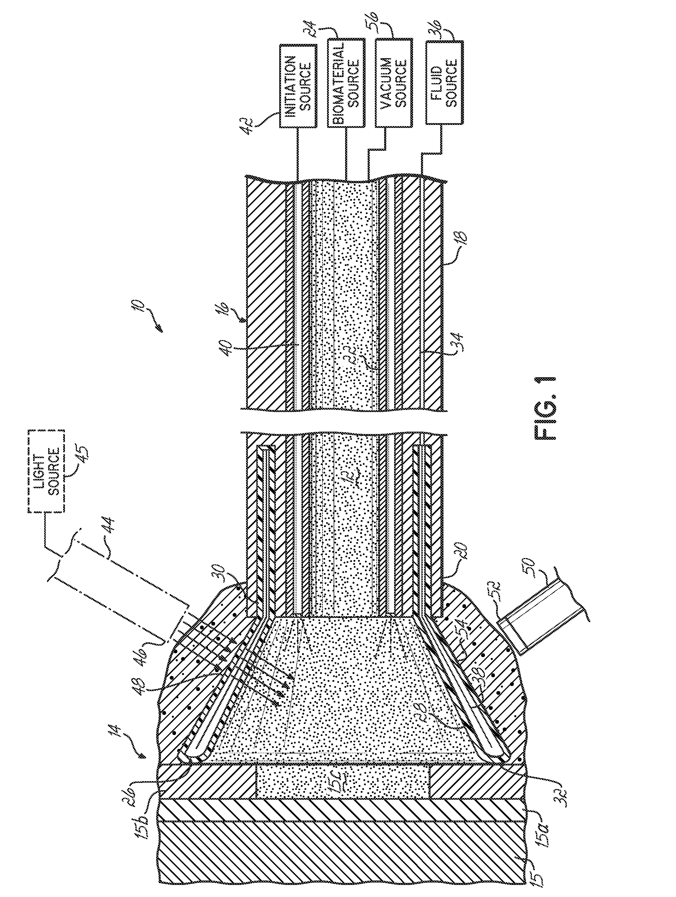 Apparatus for delivering a biocompatible material to a surgical site and method of using same