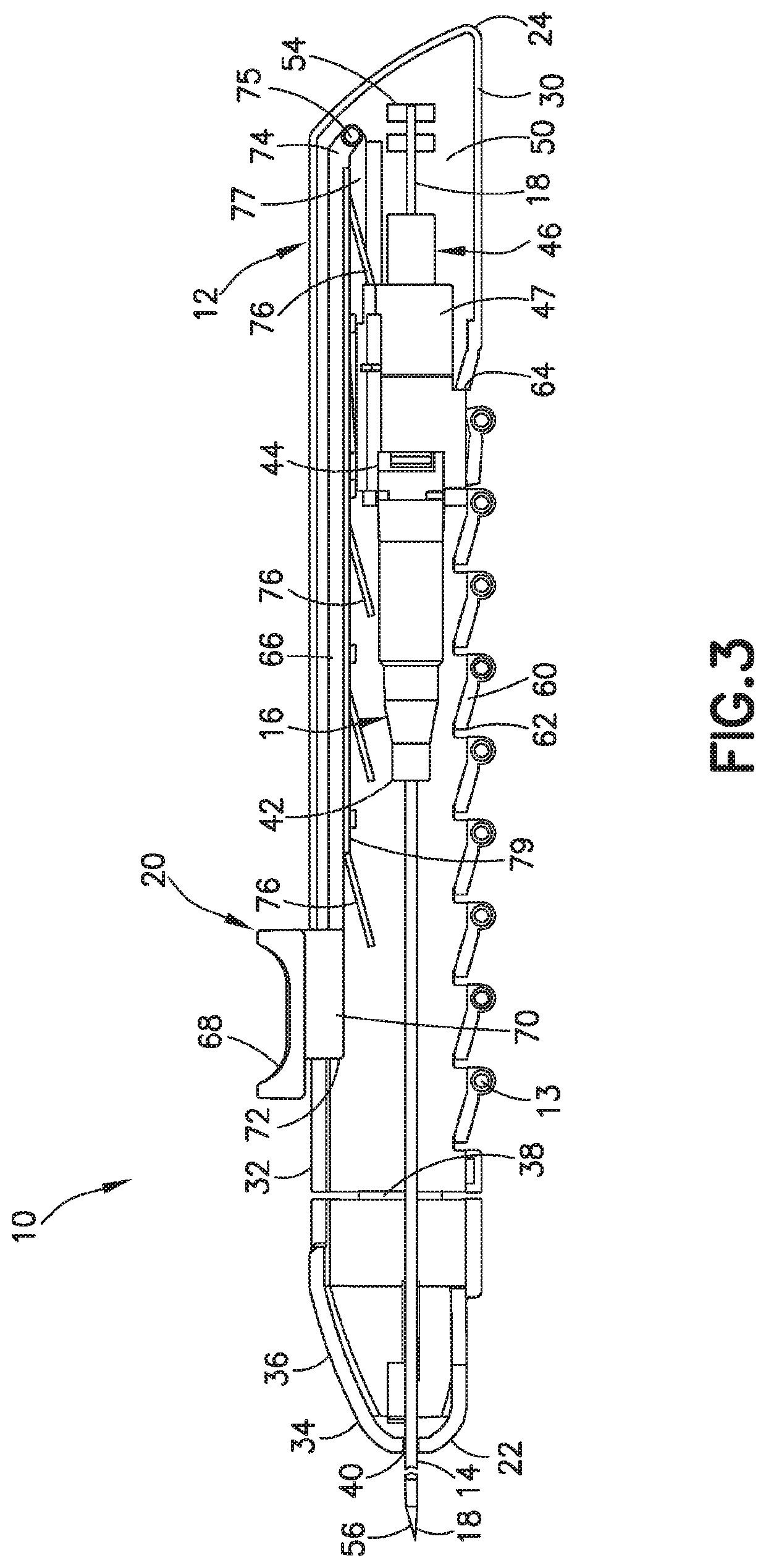 Midline catheter placement device