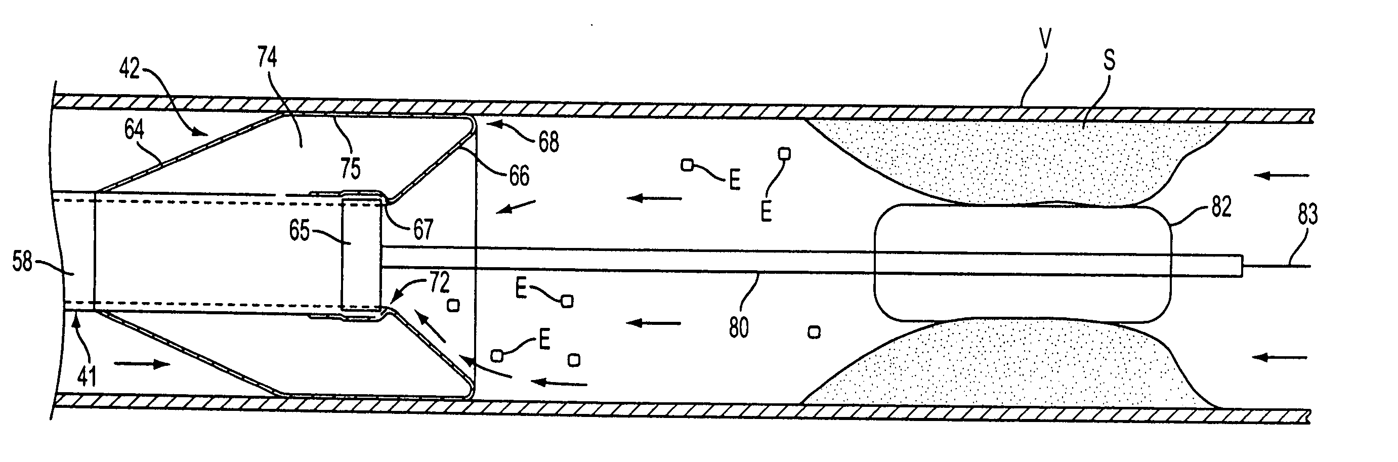 Catheter having a funnel-shaped occlusion balloon of uniform thickness and methods of manufacture