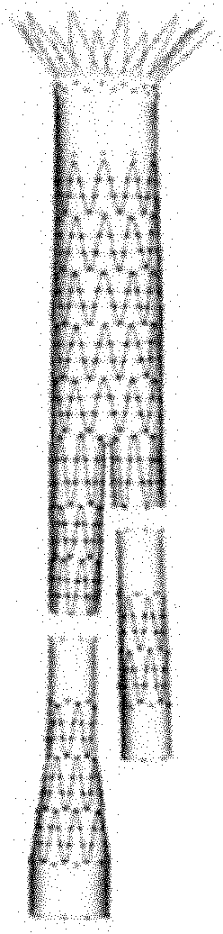 Stent vessel and dedicated traction tool for implanting stent vessel into human body