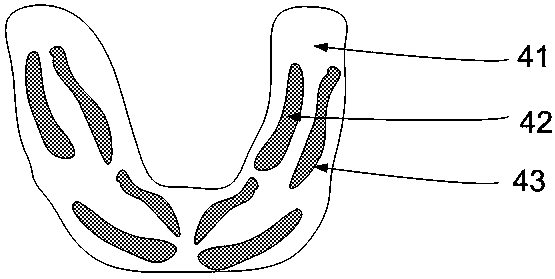 Active invisible oral appliance and manufacturing method thereof