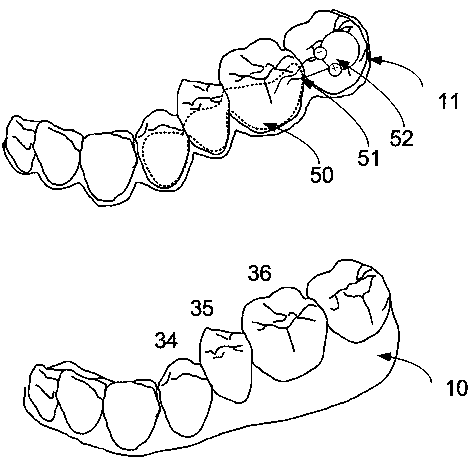 Active invisible oral appliance and manufacturing method thereof