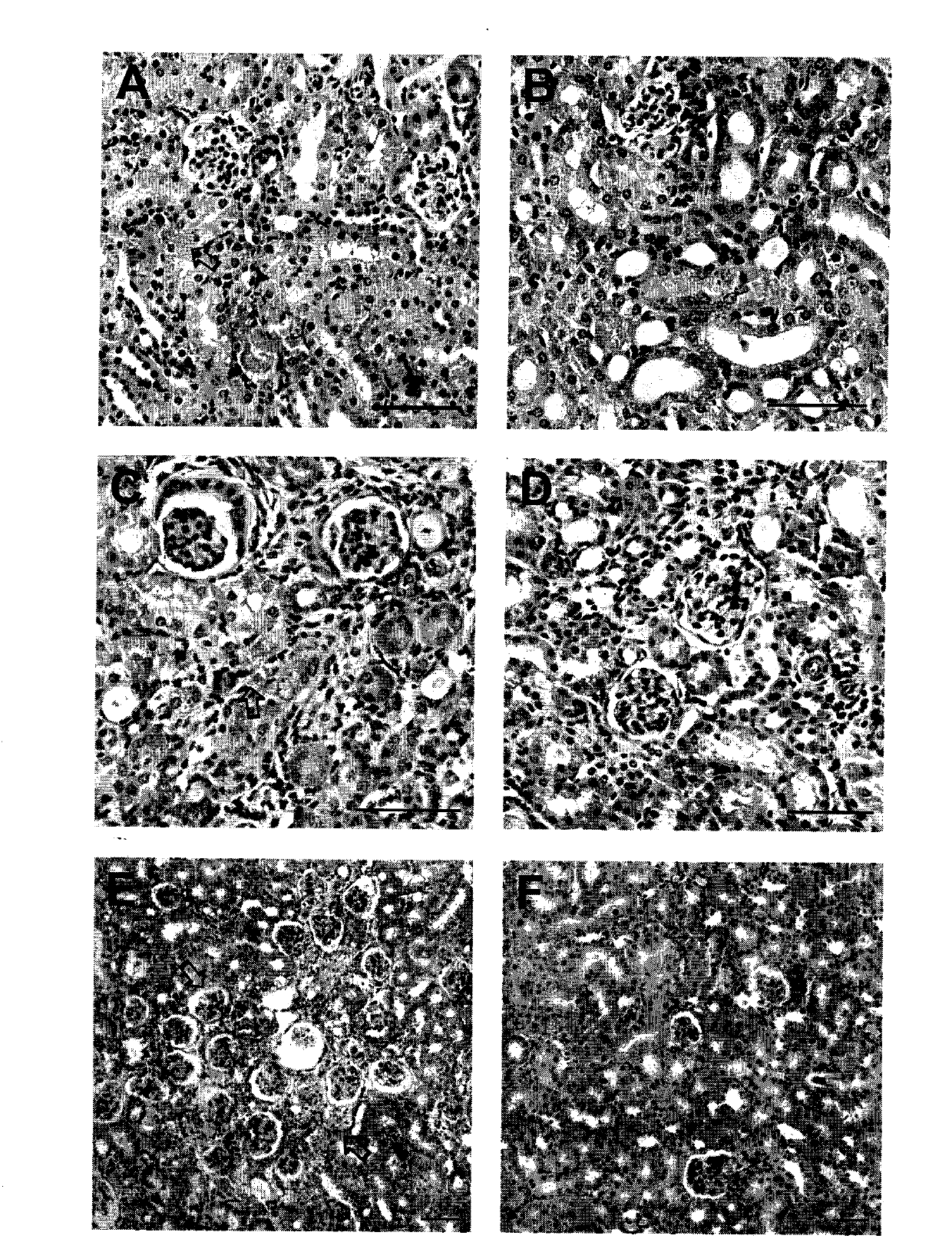 Use of human fat-derived mesenchymal stem cells in treatment of diseases in kidney and ocular fundus