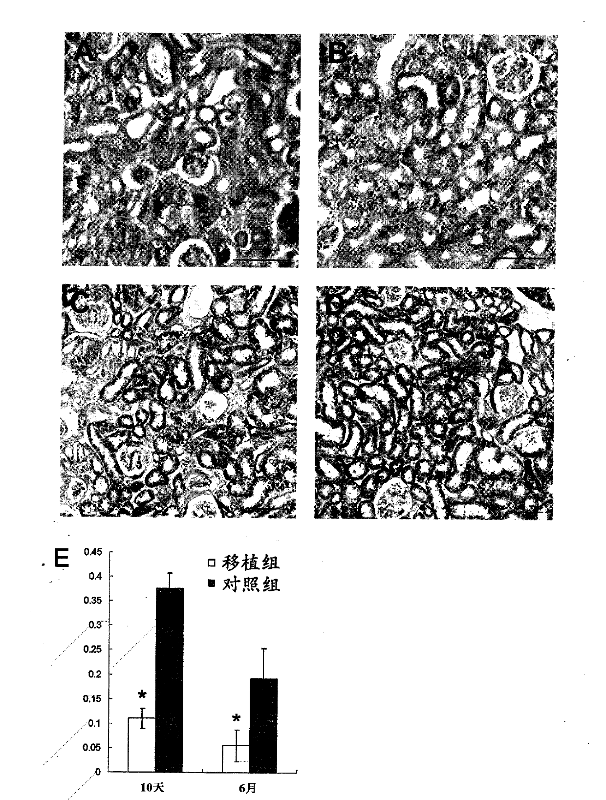 Use of human fat-derived mesenchymal stem cells in treatment of diseases in kidney and ocular fundus