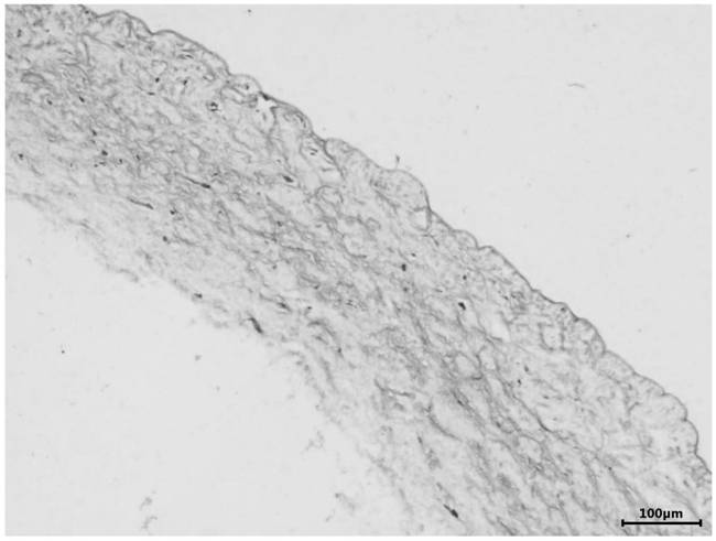 Drug-containing tissue graft and its preparation method and application