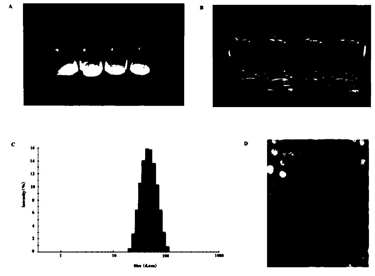 Nano-preparation and preparation method of an anticancer drug composition and its application in the treatment of malignant tumors