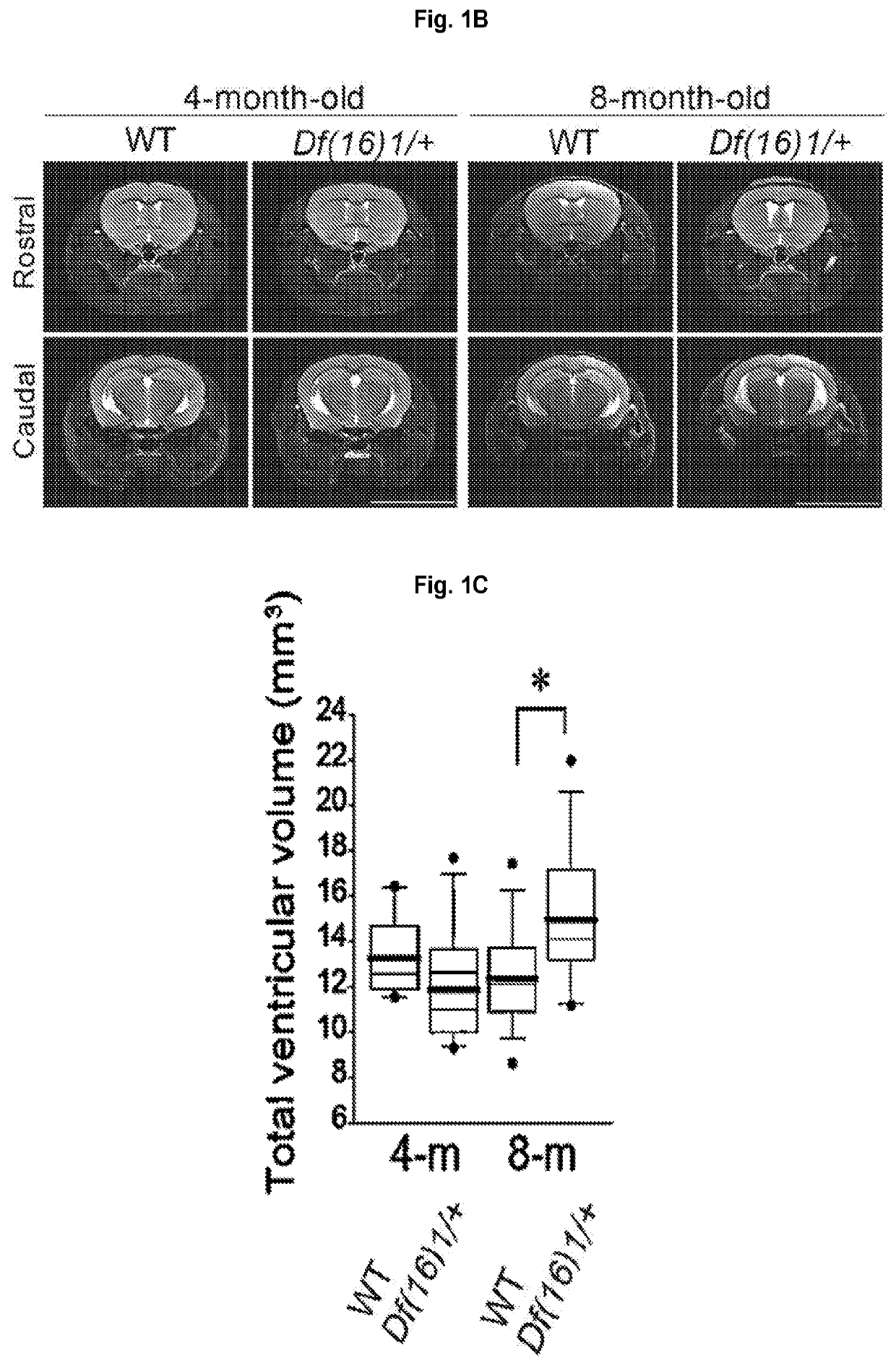 miRNAS FOR REDUCING VENTRICLE ENLARGEMENT