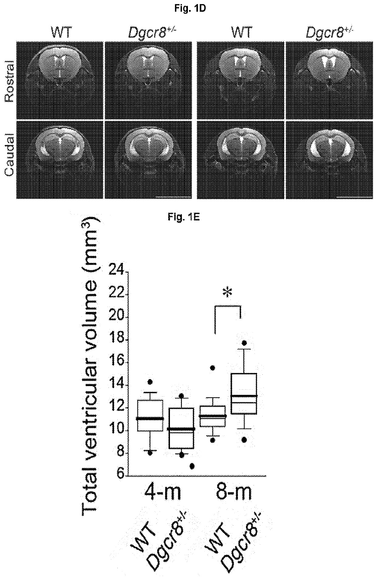 miRNAS FOR REDUCING VENTRICLE ENLARGEMENT