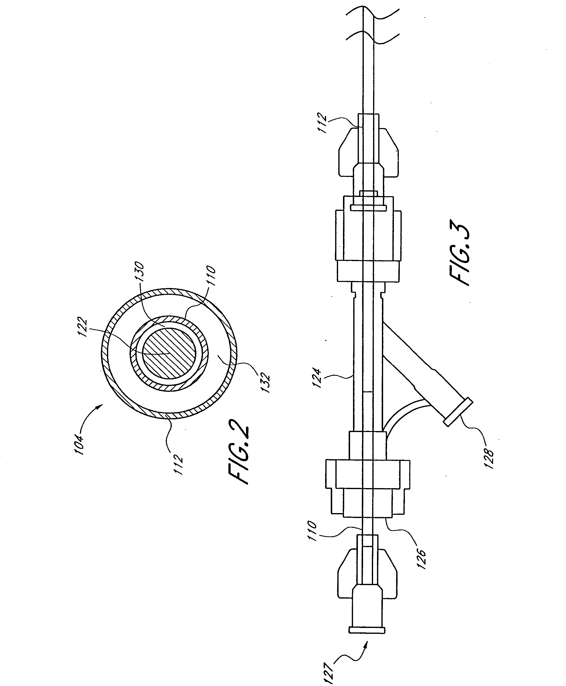 Formed in place fixation system with thermal acceleration