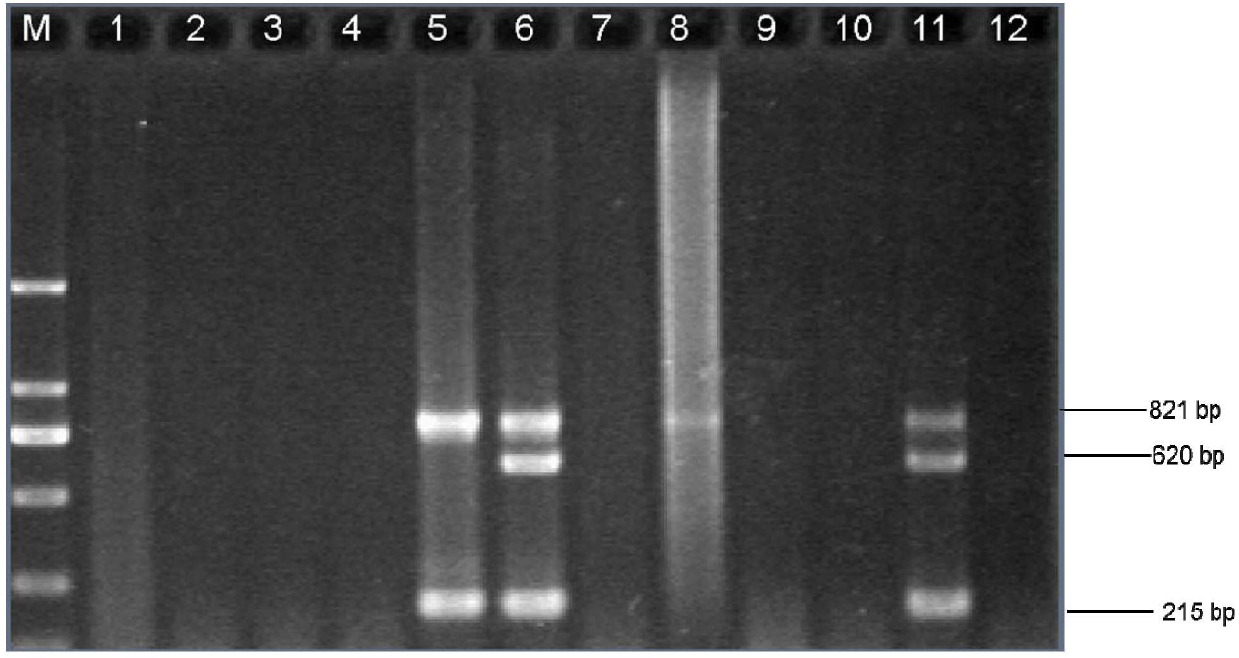 Multiple touchdown PCR (polymerase chain reaction) detection kit of haemophilus influenzae
