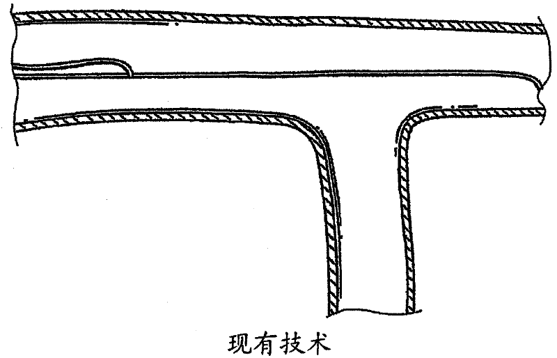 Navigation guide wire through an anatomical structure having branched ducts