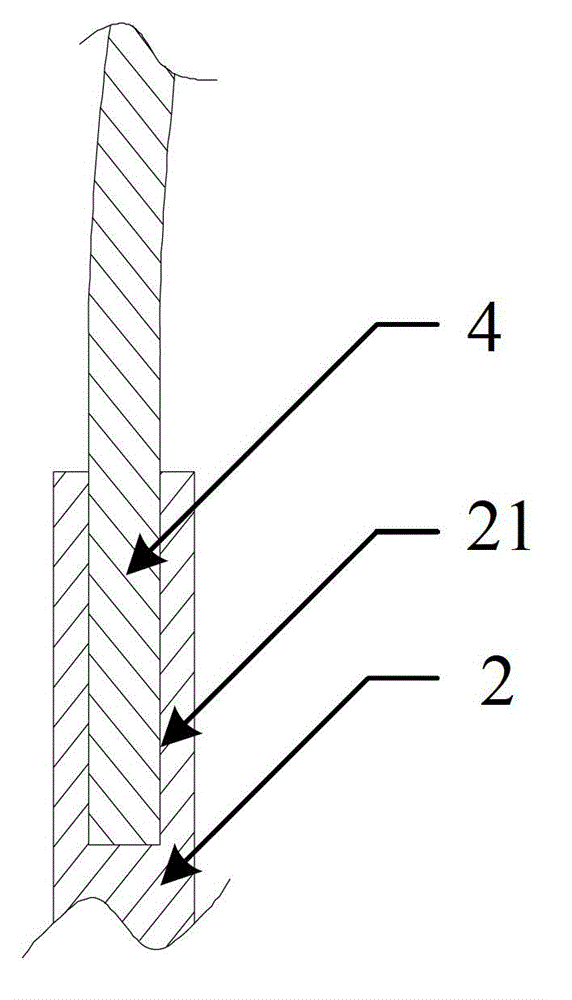 Pedicle screw and spine percutaneous internal fixing system