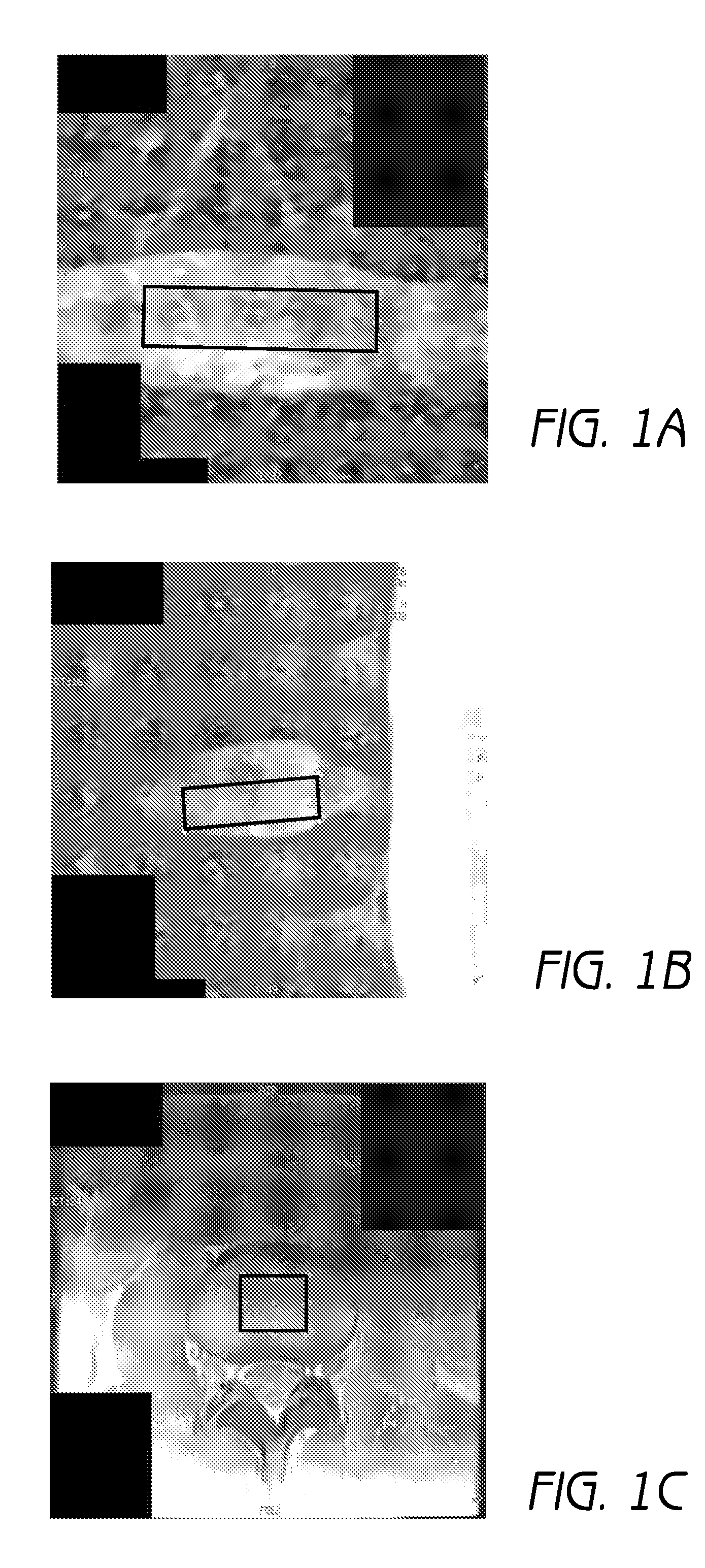Mr spectroscopy system and method for diagnosing painful and non-painful intervertebral discs