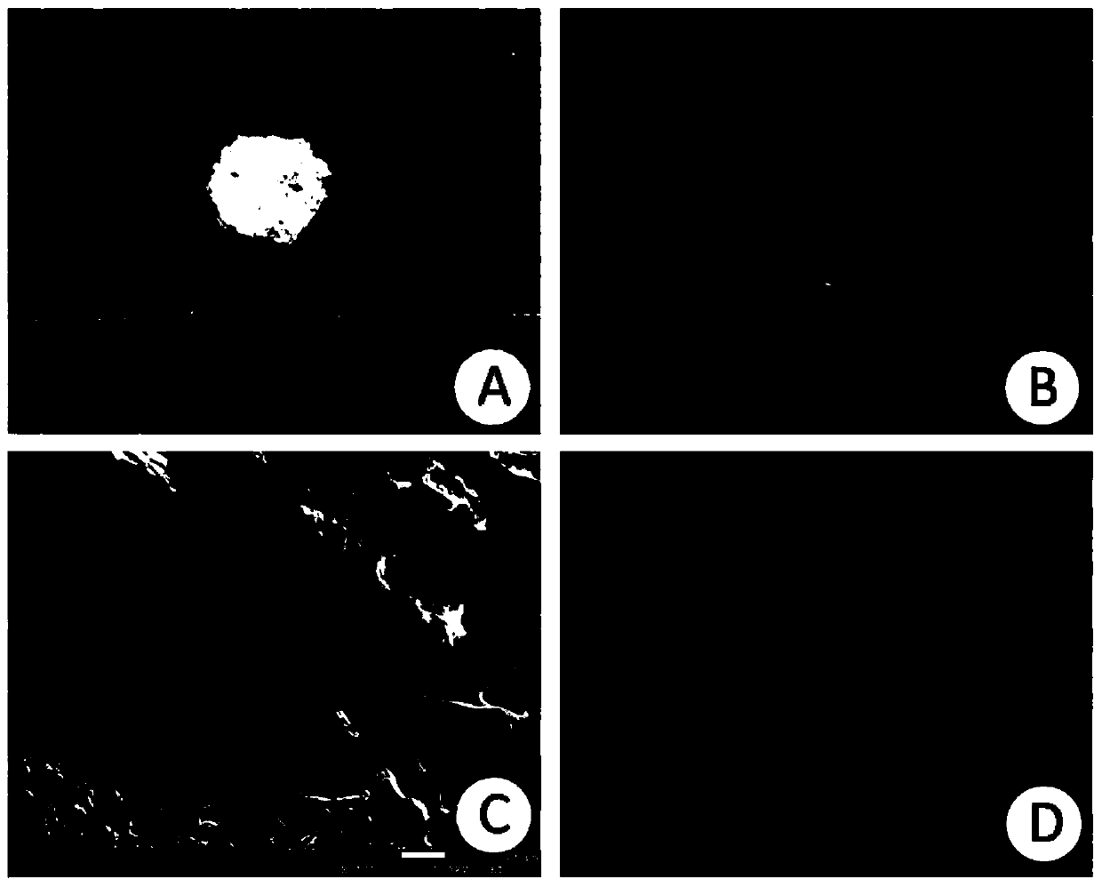 A high-performance artificial intervertebral disc support and its preparation method