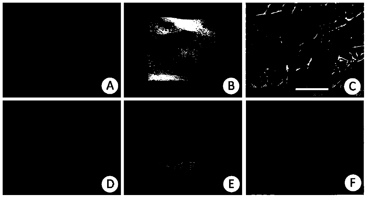 A high-performance artificial intervertebral disc support and its preparation method