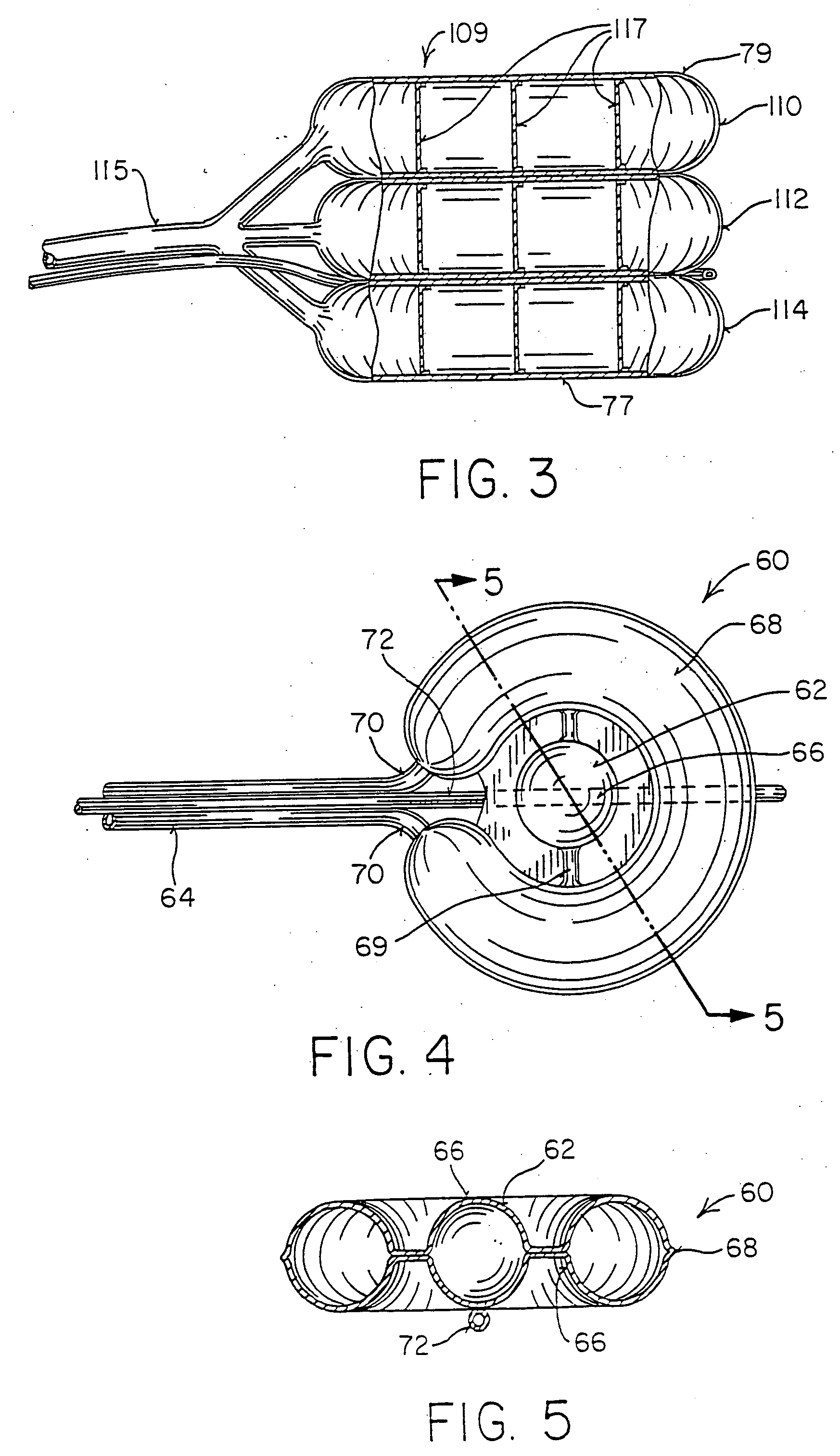 Inflatable device for use in surgical protocol relating to fixation of bone