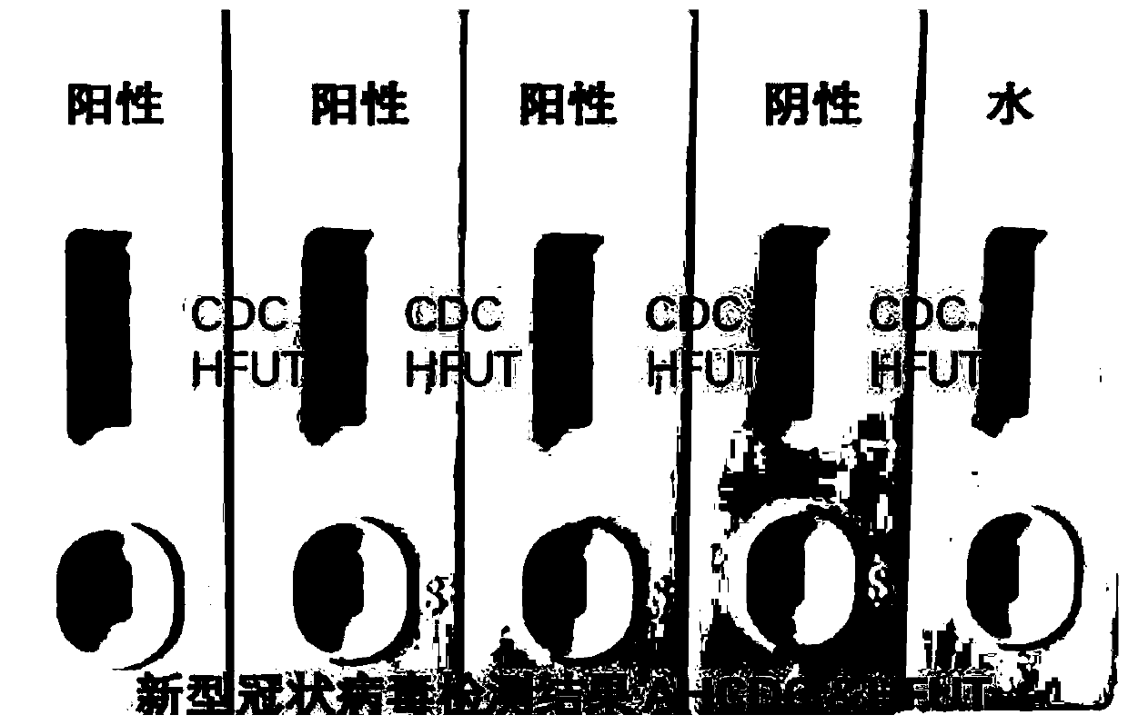 Method and test strip for rapid detection of new coronavirus nucleic acid recombinase mediated isothermal amplification lateral chromatography colloidal gold