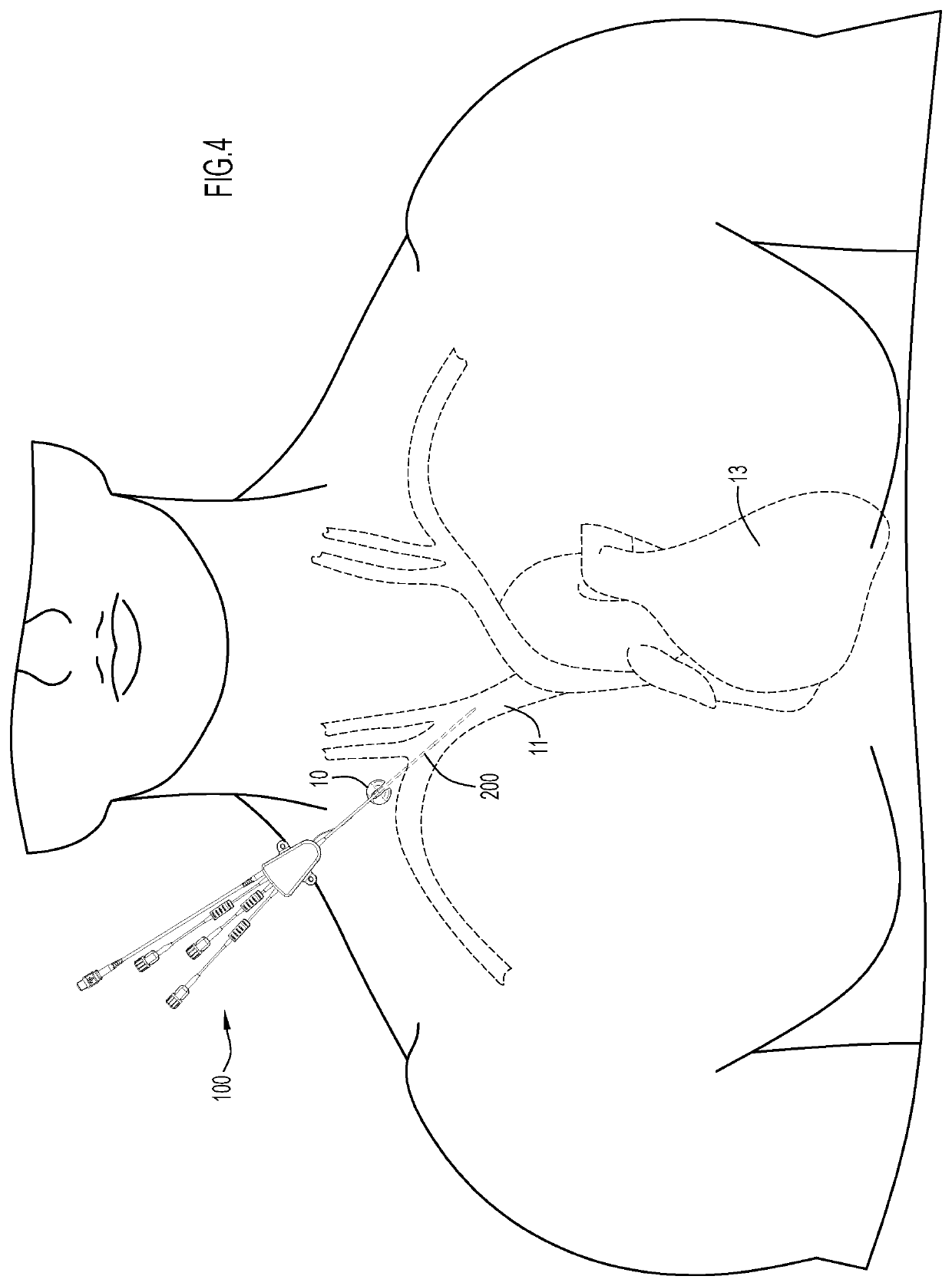 Disinfecting Methods and Apparatus