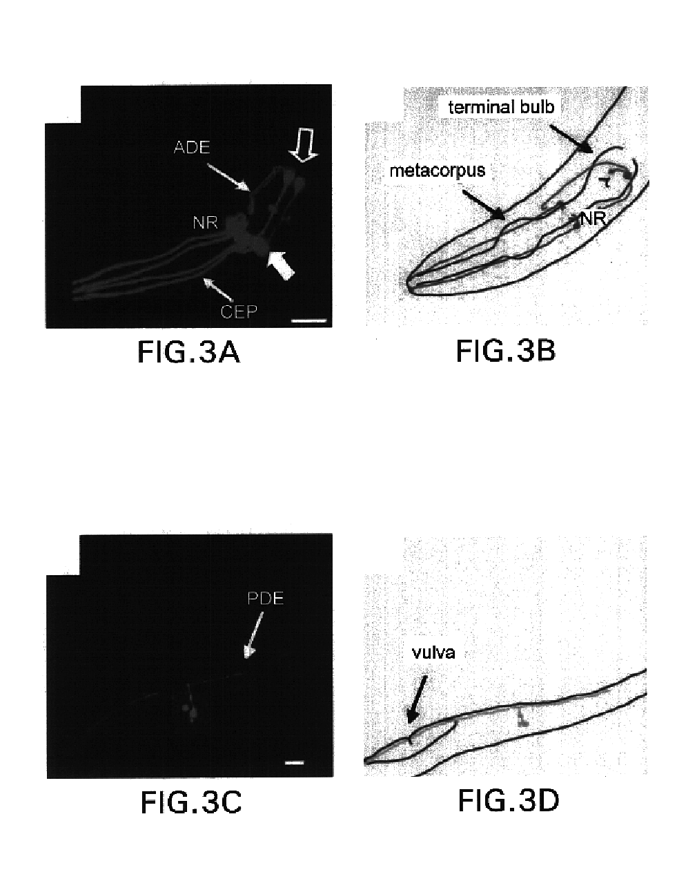 Assay for toxin induced neuronal degeneration and viability in C. elegans