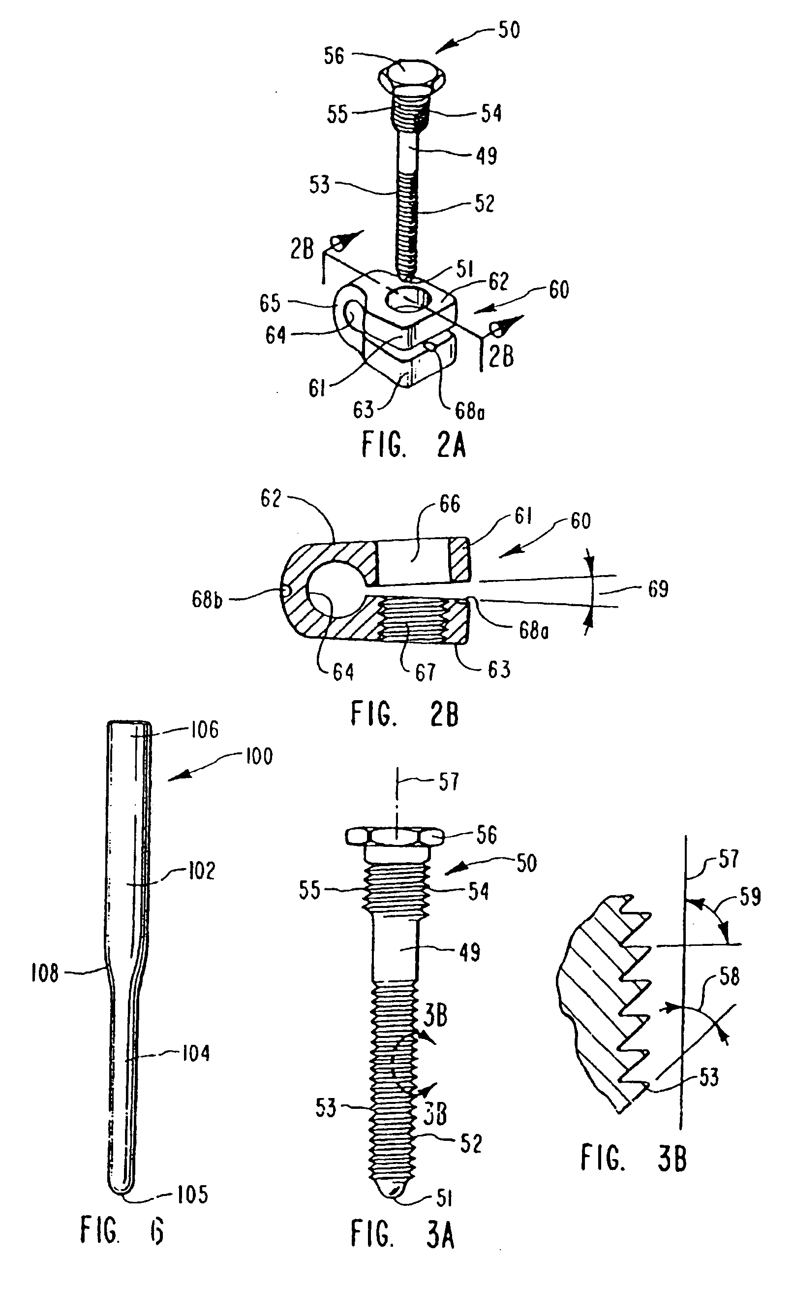 Spinal fixation apparatus and method