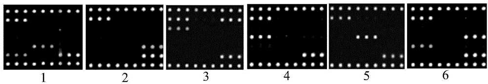 Gene chip, kit and method for detecting three viruses for immunosuppression disease of chickens