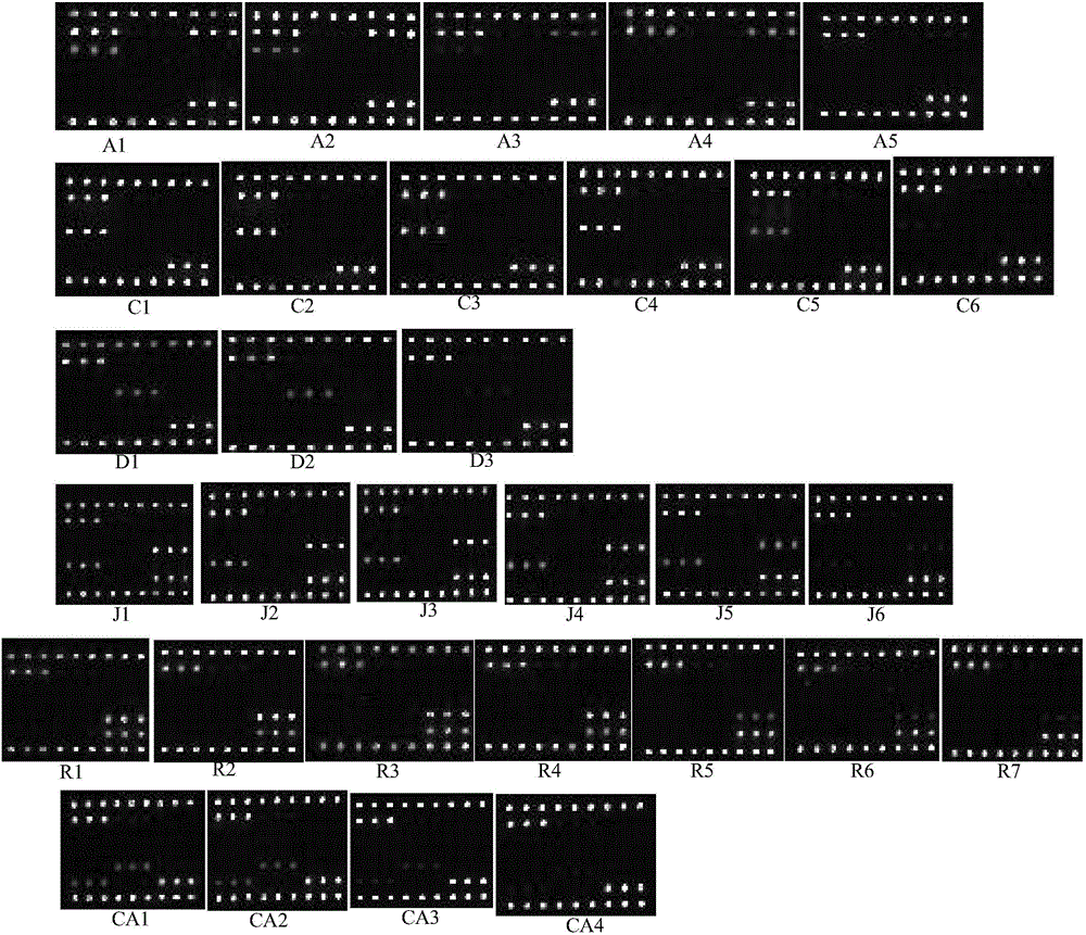 Gene chip, kit and method for detecting three viruses for immunosuppression disease of chickens