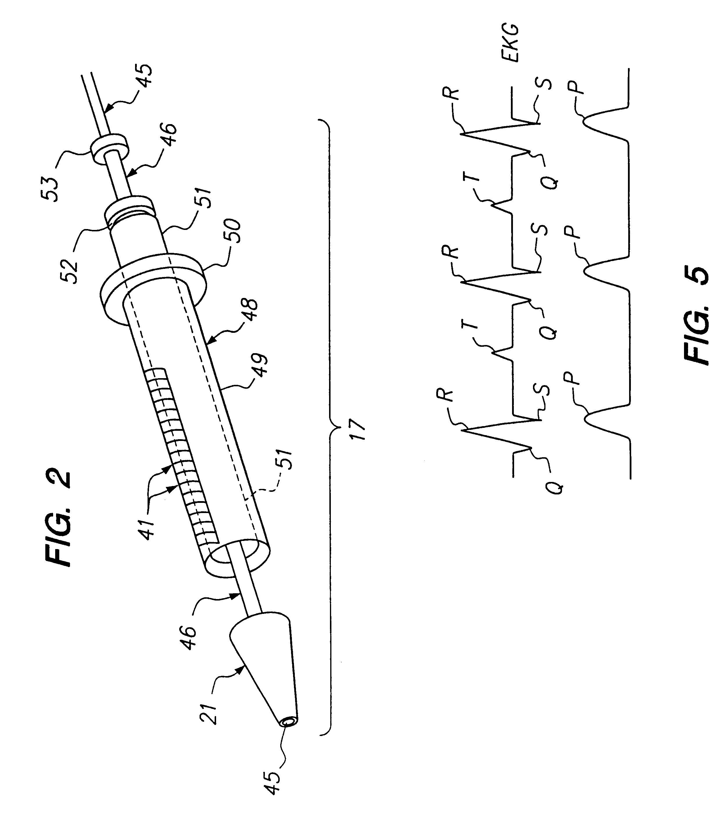 Method and apparatus for creation of drug delivery and/or stimulation pockets in myocardium