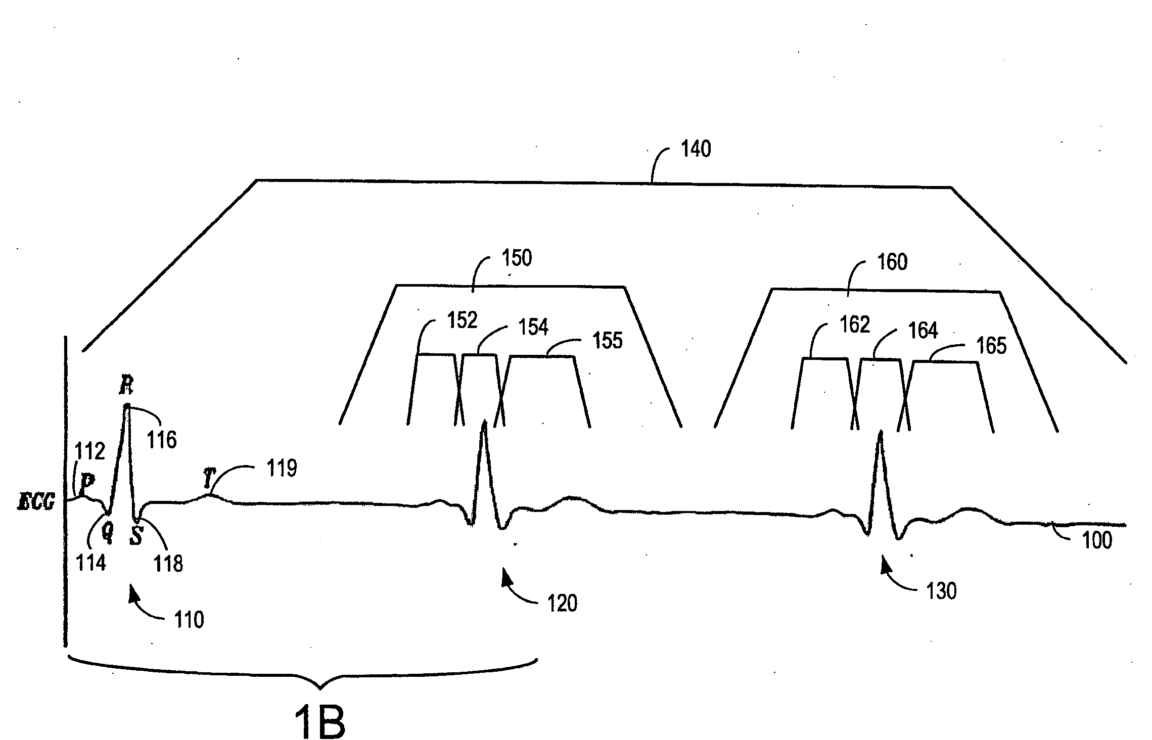 Automatic Capture Verification using Electrocardiograms Sensed from Multiple Implanted Electrodes