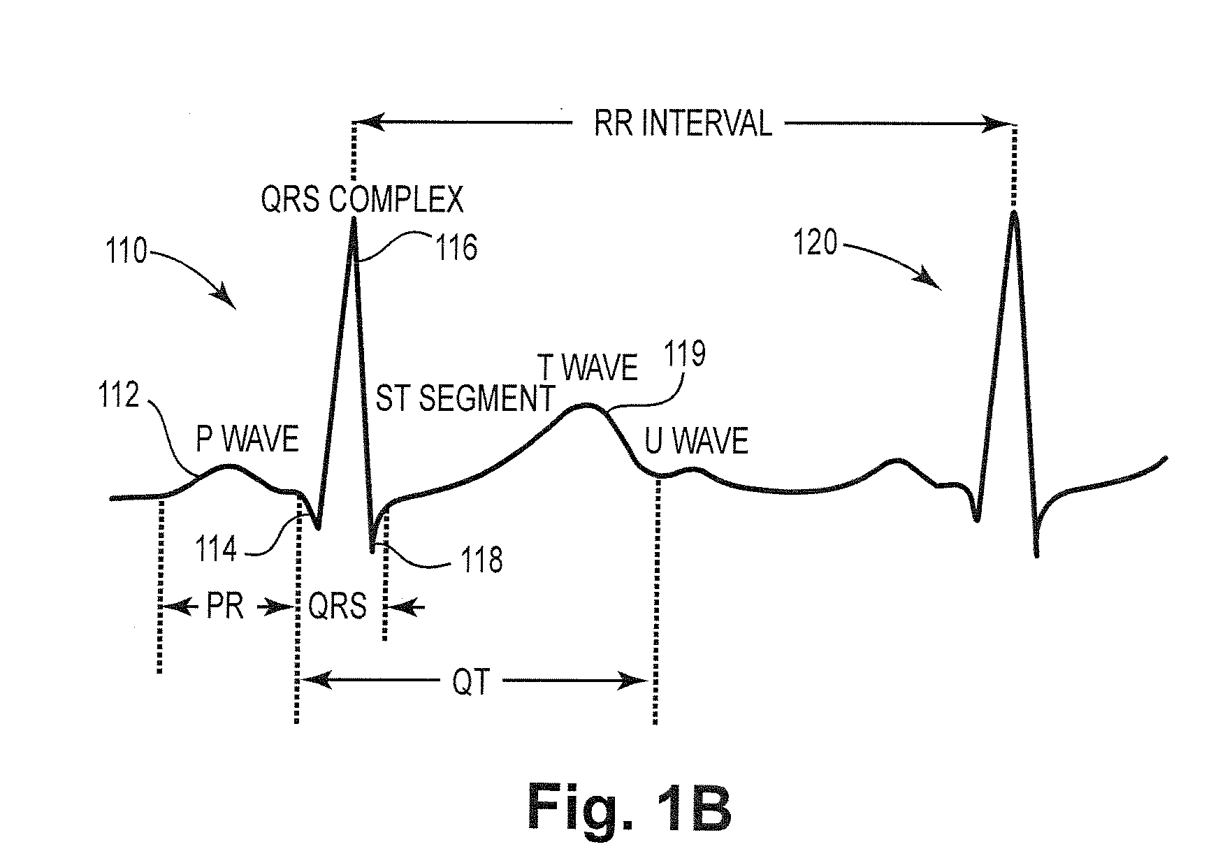 Automatic Capture Verification using Electrocardiograms Sensed from Multiple Implanted Electrodes