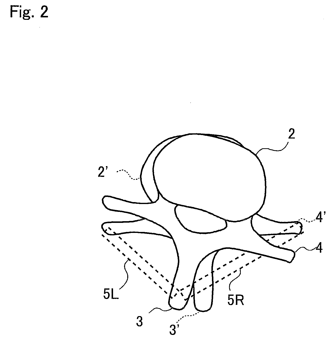 Spinal correction device