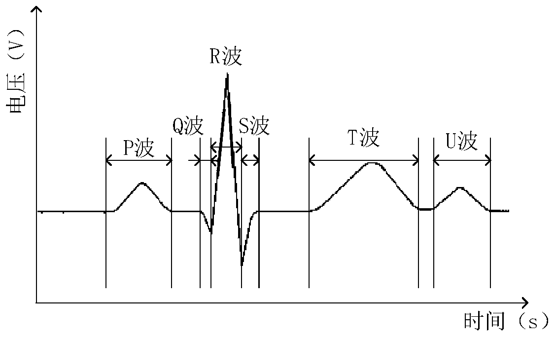Electrocardiosignal classifying method and device, electronic equipment and storage medium