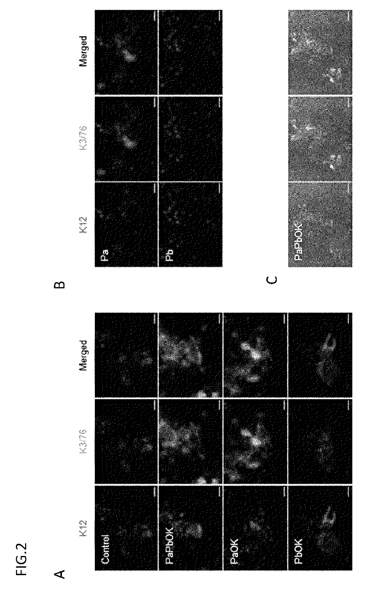 Corneal epithelioid cells derived from surface ectodermal cells